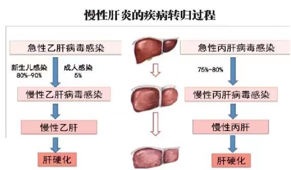 【健康科普】世界肝炎日——堅(jiān)持早預(yù)防，加強(qiáng)檢測(cè)發(fā)現(xiàn)，規(guī)范抗病毒治療